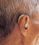 Hearing Aids
